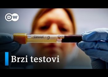 DIJAGNOZA KORONAVIRUSA ZA SAMO SAT VREMENA: Pogon kompanije u blizini Kölna