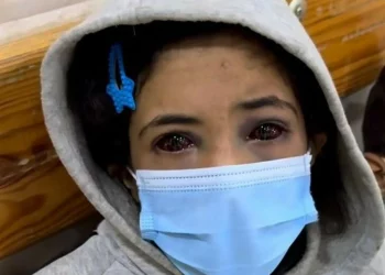 KROZ OČI OVE DJEVOJČICE SVIJET GLEDA SVU PATNJU GAZE: Izraelski tenk joj je zdrobio obitelj, a njoj uništio vid